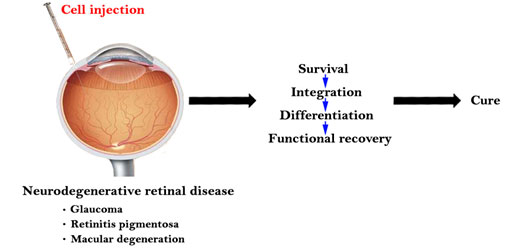 Stem cell transplantation for treatment of eye disease