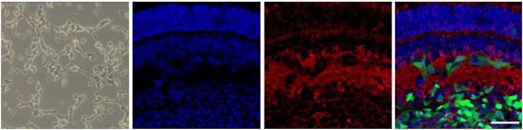 Cell culture and Transplantation